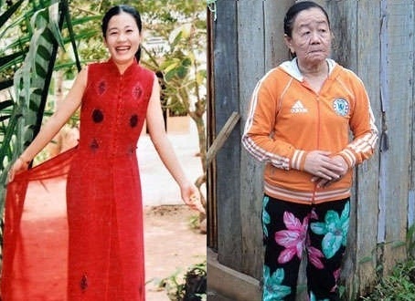 阮蒔芳