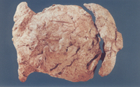 藍(lán)田猿人頭蓋骨發(fā)現(xiàn)