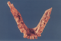 藍(lán)田猿人頭蓋骨發(fā)現(xiàn)
