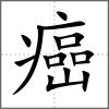 癌