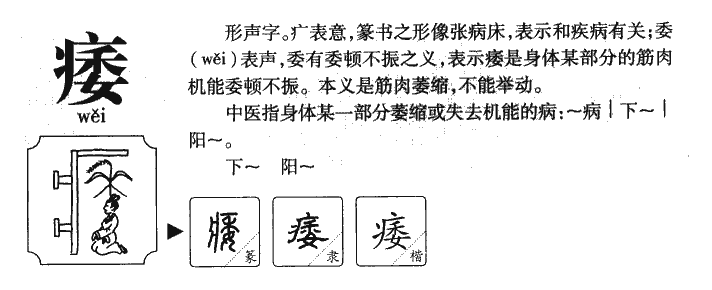 瘺